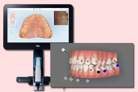 インビザラインの流れ|検査|北九州市のあらたけ歯科クリニック
