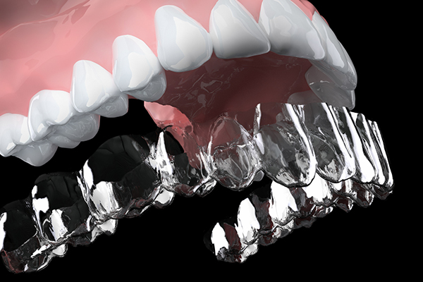 インビザライン|invisalign|北九州市のあらたけ歯科クリニック